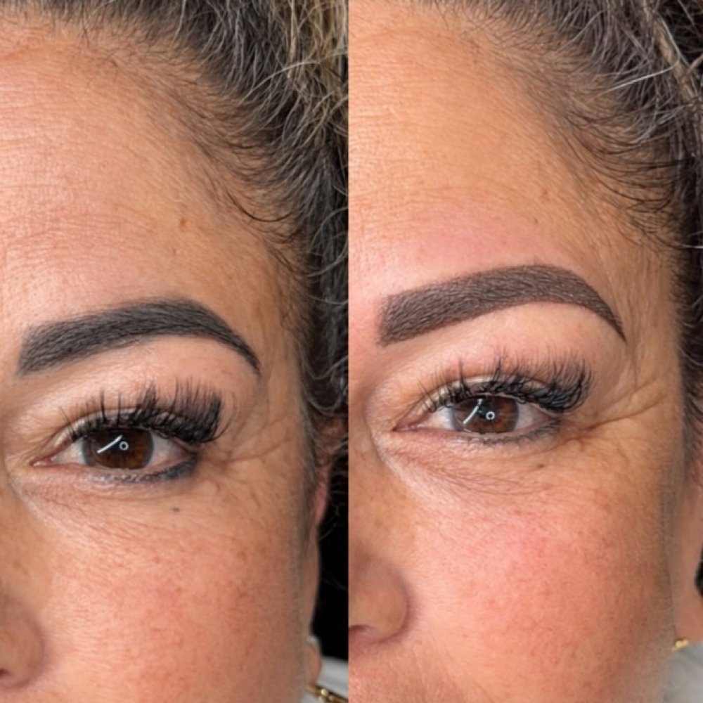 A woman laying down, getting her eyebrows permanently tattooed.